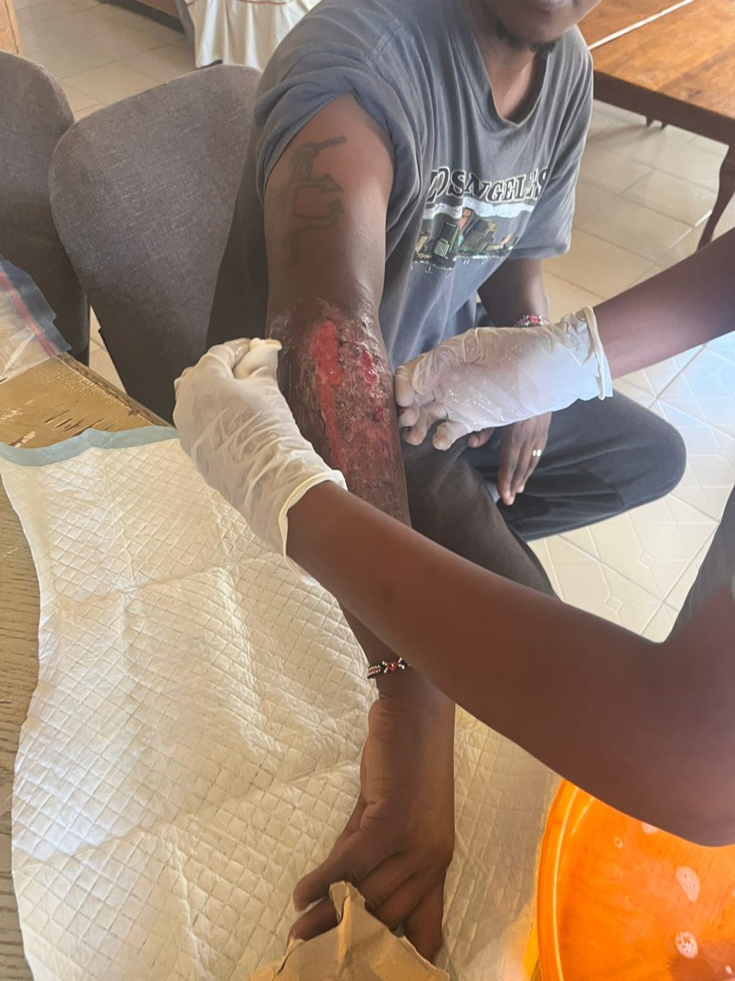 Clinician in gloves treating a patient's forearm wound